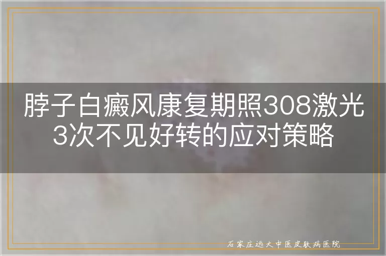 脖子白癜风康复期照308激光3次不见好转的应对策略
