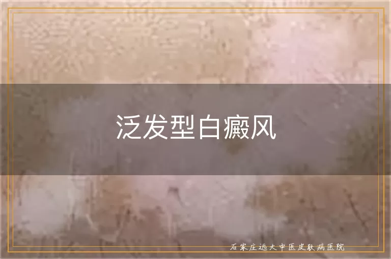 泛发型白癜风