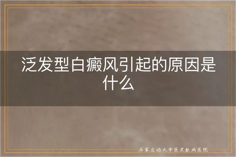 泛发型白癜风引起的原因是什么