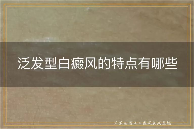 泛发型白癜风的特点有哪些