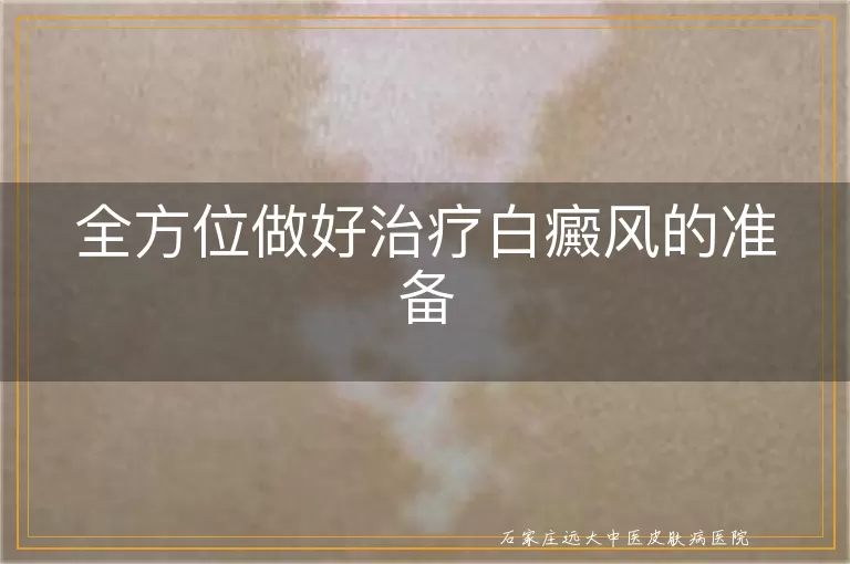 全方位做好治疗白癜风的准备