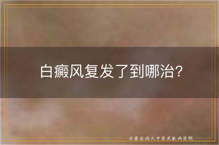 白癜风复发了到哪治?