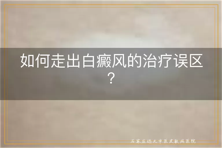 如何走出白癜风的治疗误区？