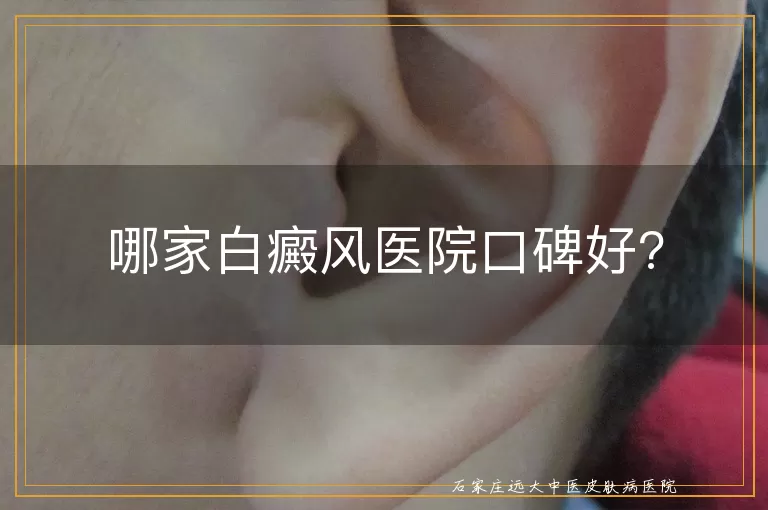 哪家白癜风医院口碑好?