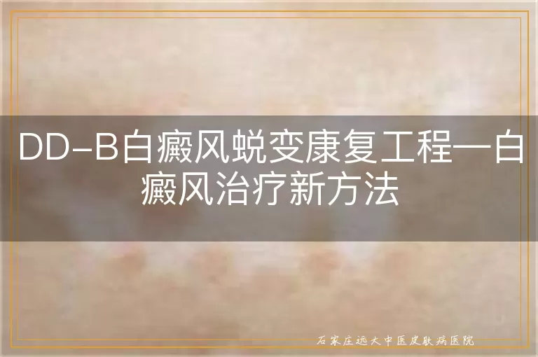 DD-B白癜风蜕变康复工程—白癜风治疗新方法