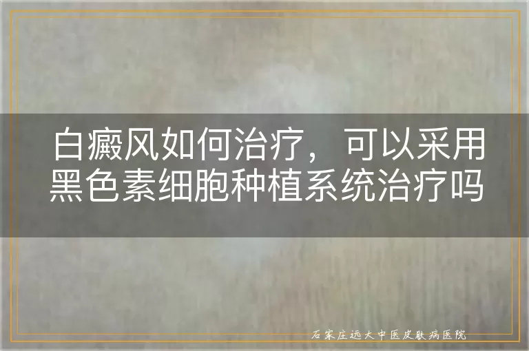白癜风如何治疗，可以采用黑色素细胞种植系统治疗吗