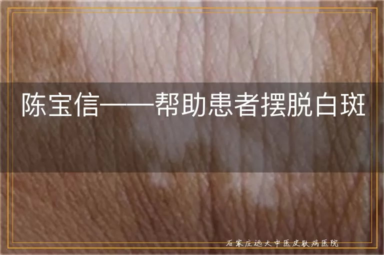 陈宝信——帮助患者摆脱白斑