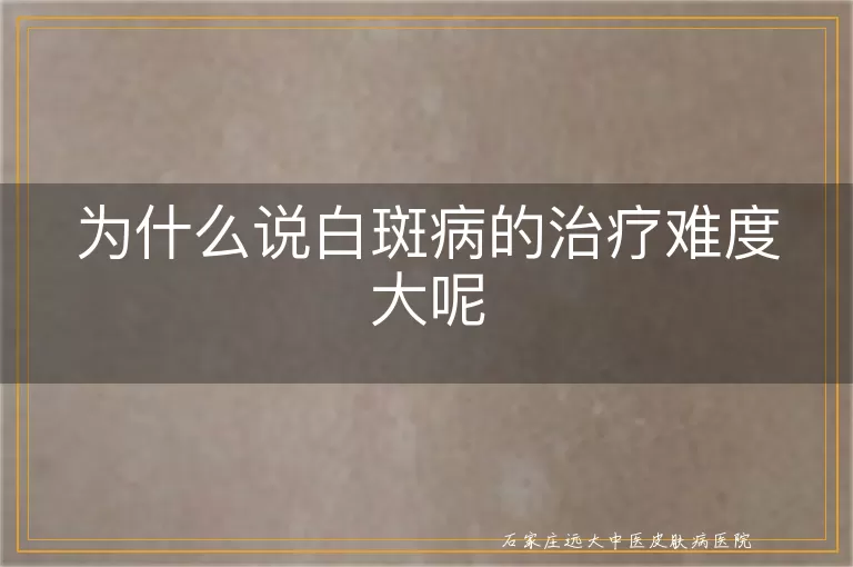 为什么说白斑病的治疗难度大呢