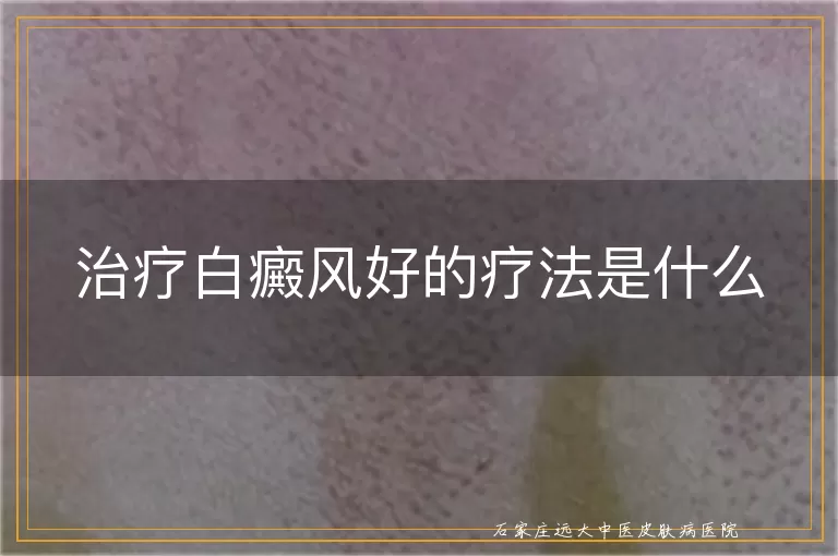 治疗白癜风好的疗法是什么