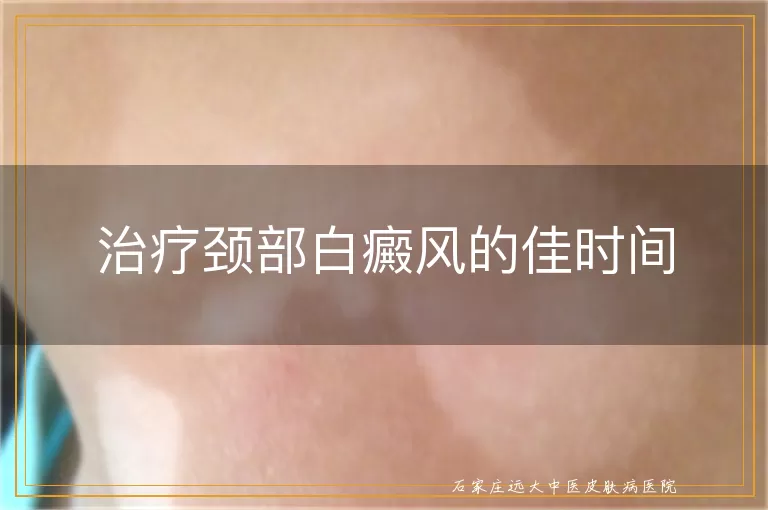 治疗颈部白癜风的佳时间