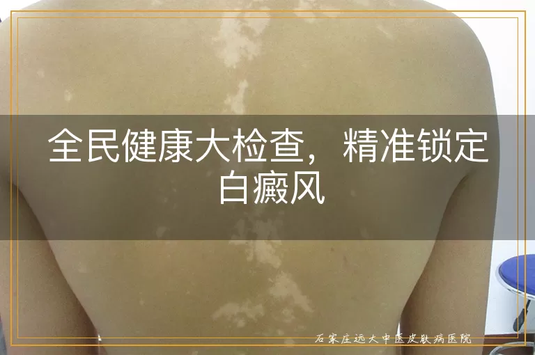 全民健康大检查，精准锁定白癜风