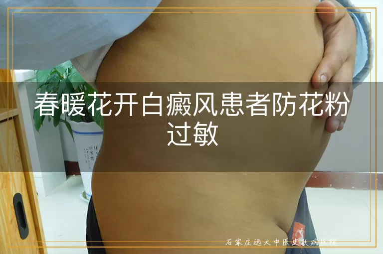 春暖花开白癜风患者防花粉过敏