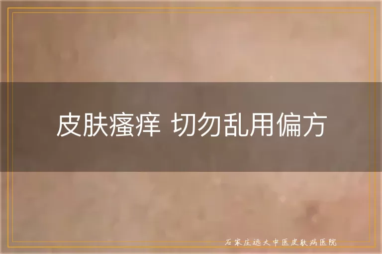皮肤瘙痒 切勿乱用偏方