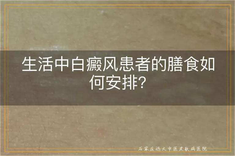 生活中白癜风患者的膳食如何安排?