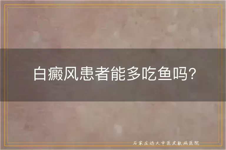 白癜风患者能多吃鱼吗?