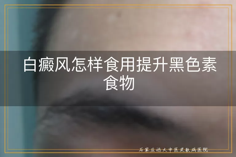 白癜风怎样食用提升黑色素食物