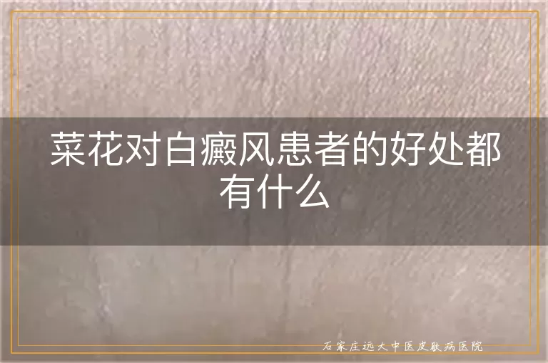 菜花对白癜风患者的好处都有什么