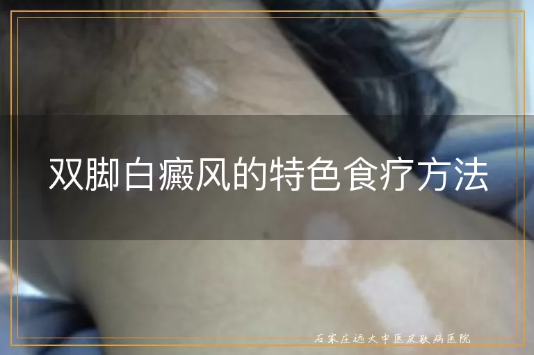 双脚白癜风的特色食疗方法