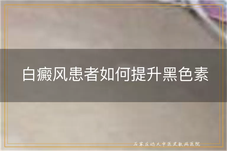 白癜风患者如何提升黑色素