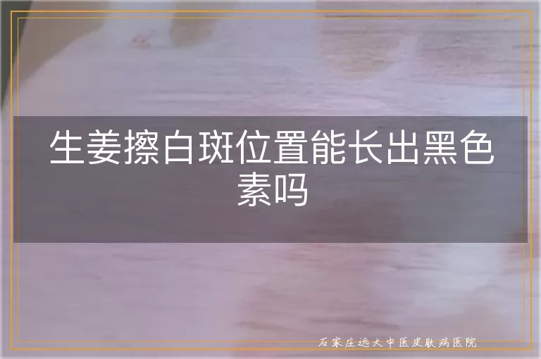 生姜擦白斑位置能长出黑色素吗