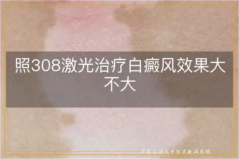 照308激光治疗白癜风效果大不大