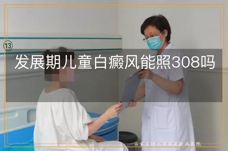 发展期儿童白癜风能照308吗