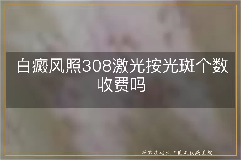 白癜风照308激光按光斑个数收费吗