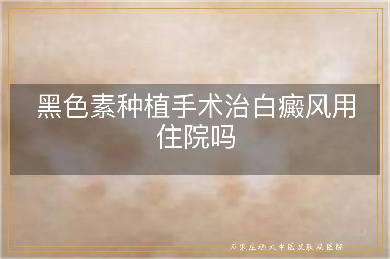 黑色素种植手术治白癜风用住院吗