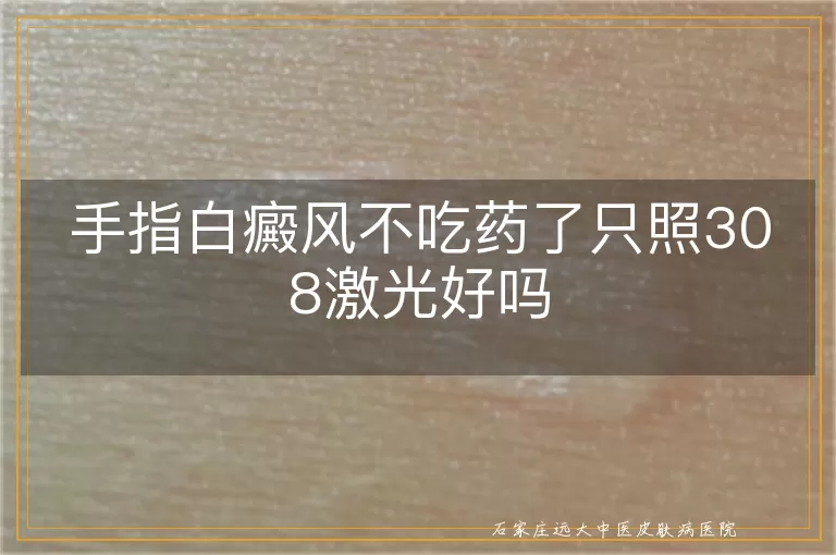 手指白癜风不吃药了只照308激光好吗