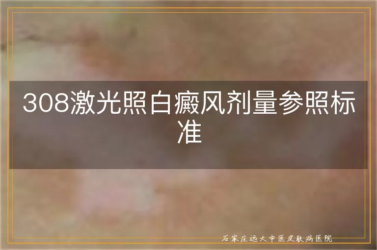 308激光照白癜风剂量参照标准