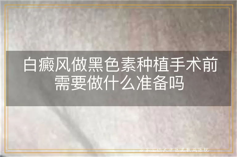 白癜风做黑色素种植手术前需要做什么准备吗