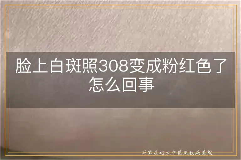 脸上白斑照308变成粉红色了怎么回事