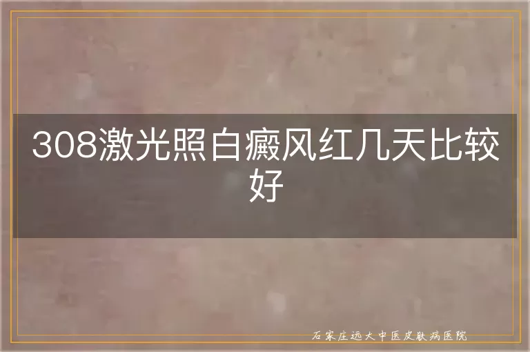 308激光照白癜风红几天比较好
