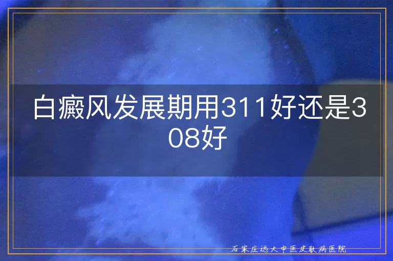 白癜风发展期用311好还是308好