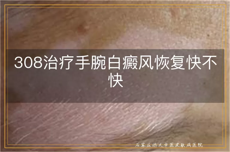 308治疗手腕白癜风恢复快不快