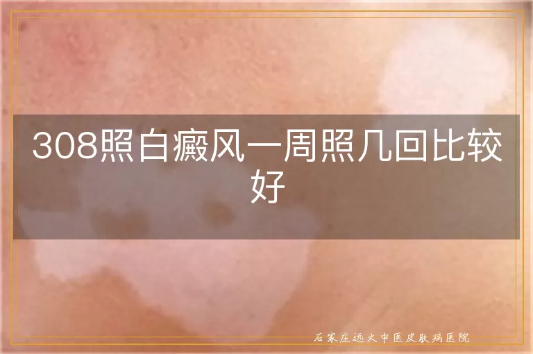 308照白癜风一周照几回比较好