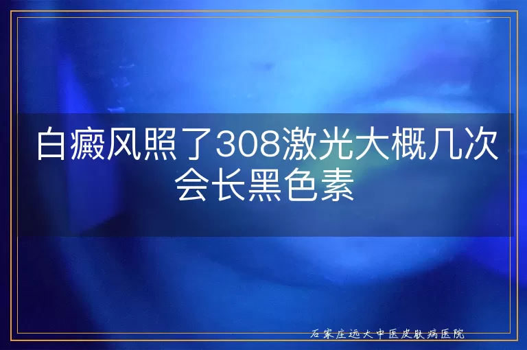 白癜风照了308激光大概几次会长黑色素