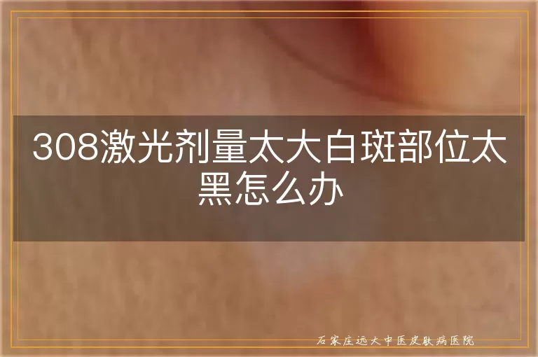 308激光剂量太大白斑部位太黑怎么办