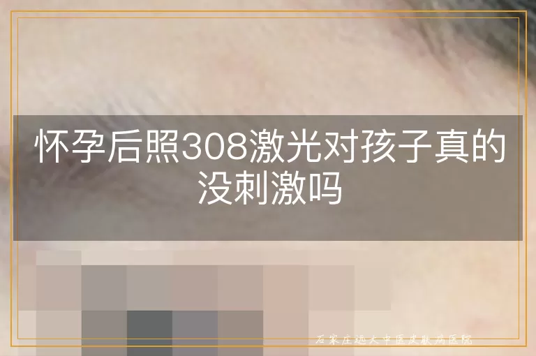 怀孕后照308激光对孩子真的没刺激吗