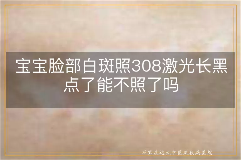 宝宝脸部白斑照308激光长黑点了能不照了吗