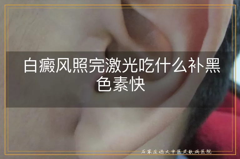 白癜风照完激光吃什么补黑色素快