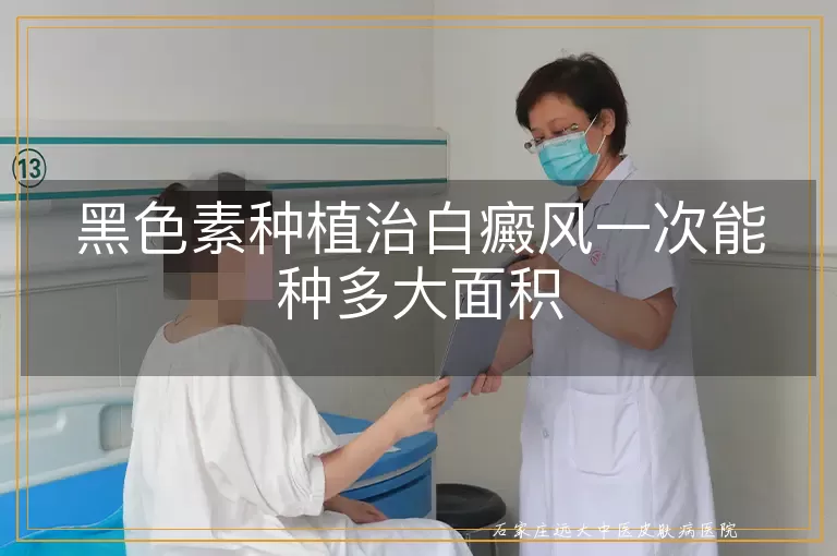 黑色素种植治白癜风一次能种多大面积