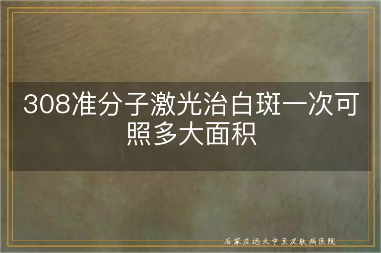 308准分子激光治白斑一次可照多大面积