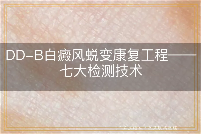 DD-B白癜风蜕变康复工程——七大检测技术