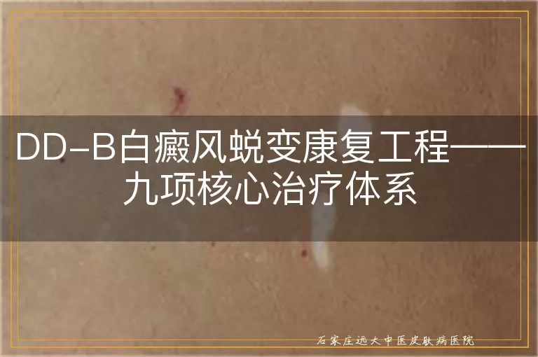 DD-B白癜风蜕变康复工程——九项核心治疗体系