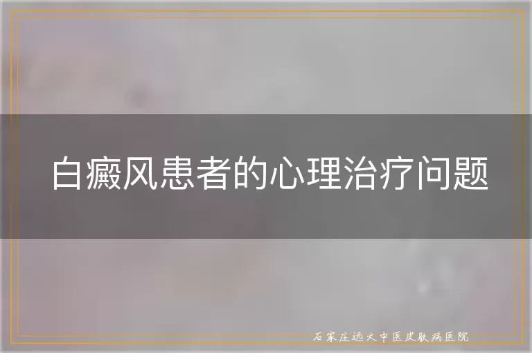 白癜风患者的心理治疗问题