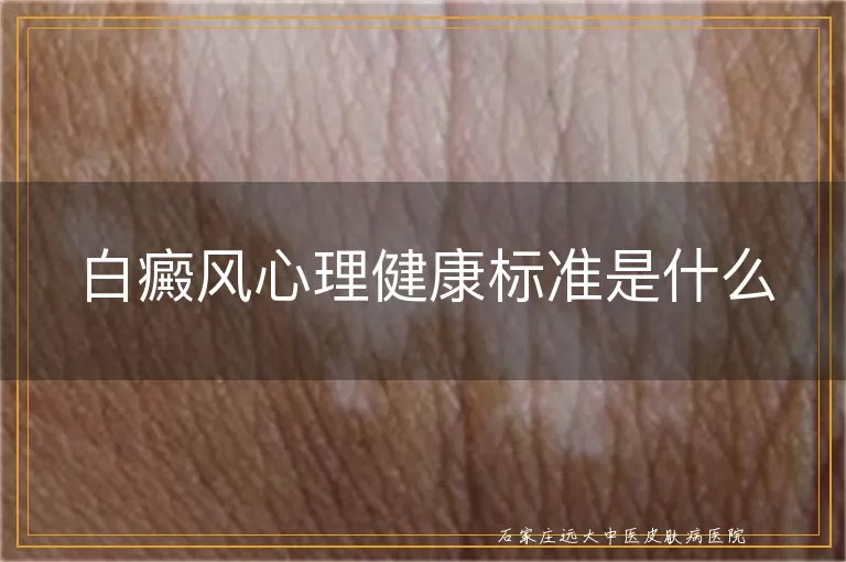 白癜风心理健康标准是什么