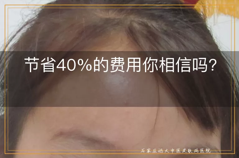 节省40%的费用你相信吗?