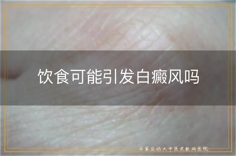 饮食可能引发白癜风吗