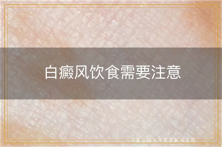 白癜风饮食需要注意